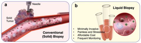 건국대 전봉현 교수팀 연구 결과. 기존 생검(왼쪽)과 액체 생검(오른쪽)의 모식도, 액체 생검은 병변 조직을 직접 취하는 기존 생검과 달리 체액으로 흘러 들어간 바이오마커를 검출해 최소침습 혹은 비침습적이며 환자의 고통과 스트레스가 적다